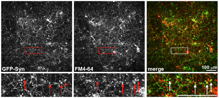 Imaging synapses