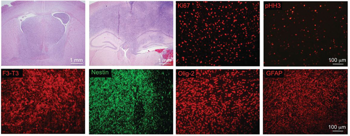 Transforming activity of FGFR-TACC fusion proteins